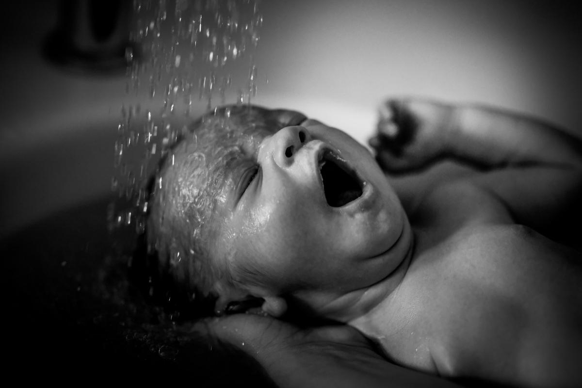 Malaise grave d'un nouveau-né en salle de réveil, sous-estimation de la  prématurité - Prévention médicale